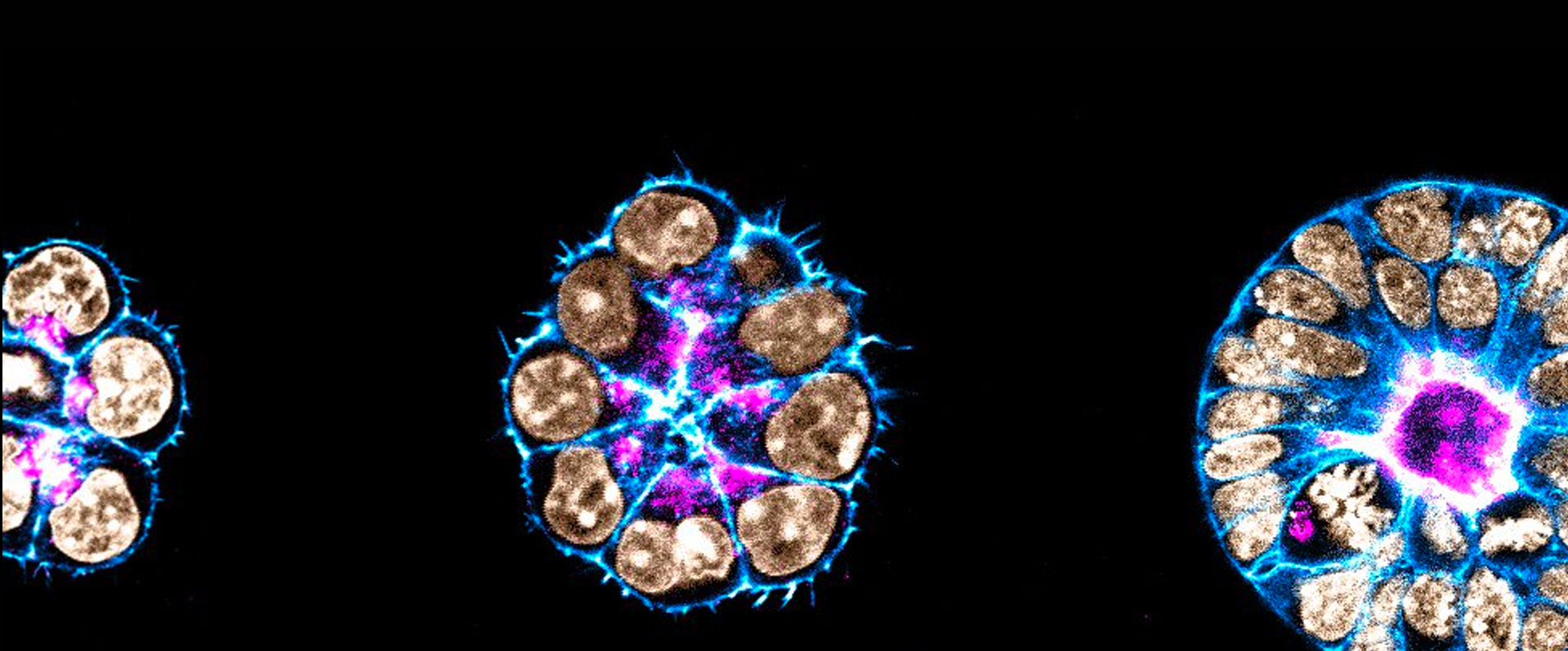 Professor Magdalena Zernicka-Goetz: Studying early embryonic development