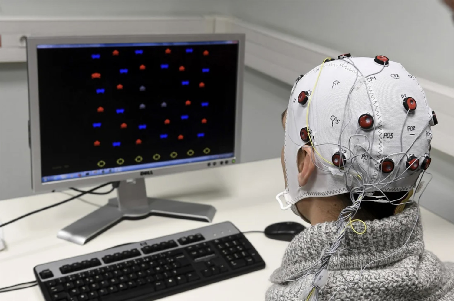 Shanghai hospital clears ethical reviews for chip brain implant treatment for depressed patients
