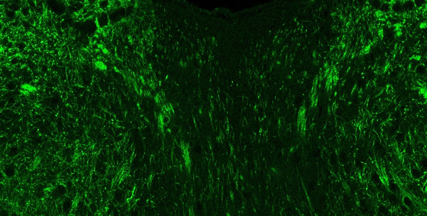 肠道里的微生物复合物导致小鼠的焦虑行为