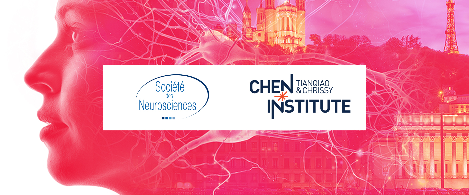 NeuroFrance 2023 Cassandre Vielle 论文报告